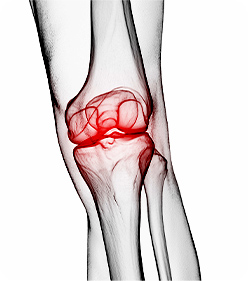 근육 · 인대 손상