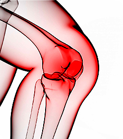 무릎, 고관절 등 만성 통증 질환