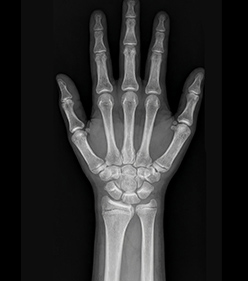 성장판 · 성장발달 문제